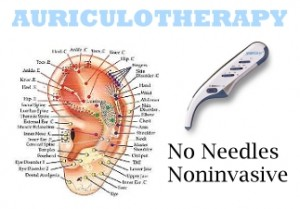 Auriculotherapy Therapy